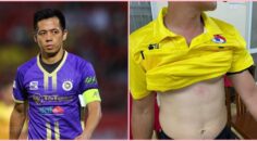 Thúc cùi trỏ khiến trọng tài bị bầm phải đi truyền nước: Hà Nội FC kêu oan cho Văn Quyết nỗi gì ?